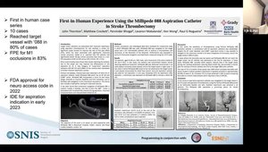 New Aspiration Catheters and Stent Retrievers in Stroke Intervention ...