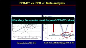 Debate: CCTA and FFR-CT Should Be the First Choice in the Assessment of ...