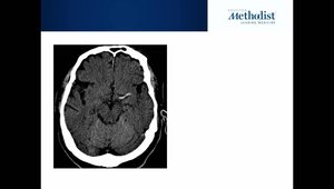 Neuroradiology: Basic Interpretation of CT & MRI | Vumedi
