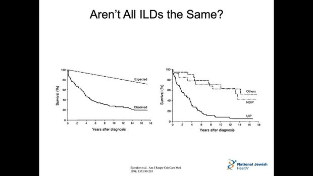 ILD Diagnostic Pathway: What Is It & How to Diagnose? | Vumedi