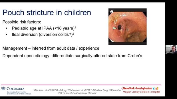 Management of Pouch Disorders in Pediatric Patients | Vumedi