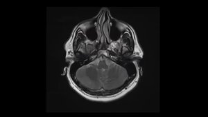 Introduction to Brain MRI Routine Sequences and How to Use Them | Vumedi