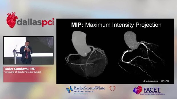 Translating CT Data to PCI in the Cath Lab - 2025 Update | Vumedi