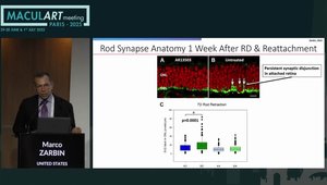 Retinal Detachment: Effects of Rho Kinase Inhibition on Rod and Cone ...