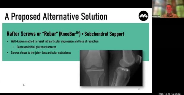 bpc 157 bone fracture Subchondral in the Knee Joint: Understanding Insufficiency and Its Clinical Impact Buy BPC-157 UK | 99%+