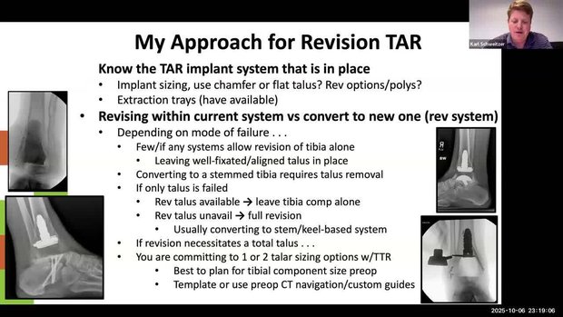 Performing Revision TAR: When and How? | Vumedi