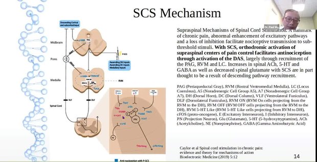 Neurostimulation for Pain Management in PD: What Are the SCS Waveform ...