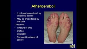 Red, White and Blue Fingers and Toes - Challenging Vascular Diagnoses ...