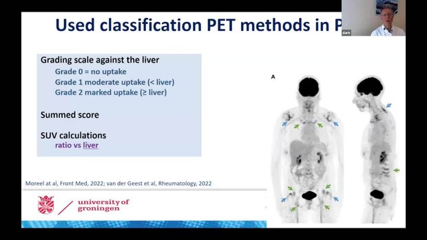 EULAR 2023 Insights: What does FDG-PET/CT Show in Patients With Signs ...