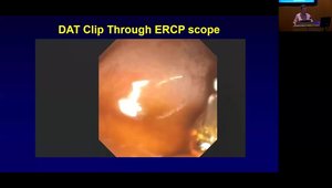 EMR and ESD Defect Closure | Vumedi