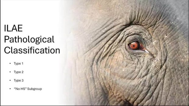 JC Discussion: Radiologic Classification of Hippocampal Sclerosis in ...
