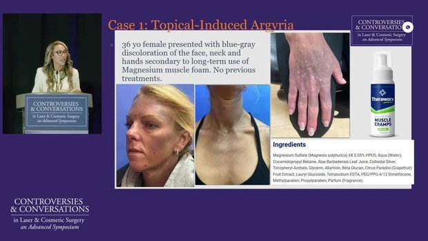 Ablative Fractional Laser Resurfacing (AFLR) in Skin of Color; and ...