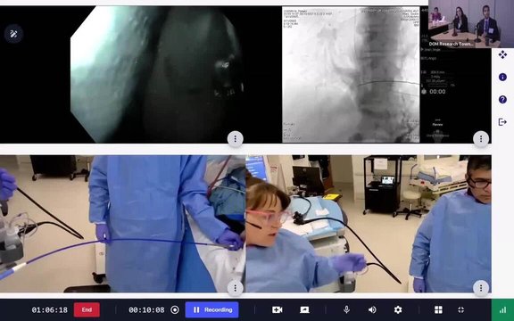 Live EGD with Esophageal Stent Placement | Vumedi