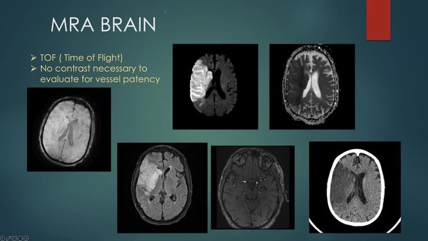 Intro to Head CT and MRI; Imaging Findings of Common Neurological ...