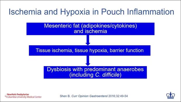 Management of Pouchitis and Its Complications | Vumedi