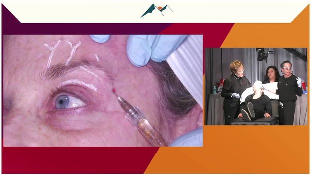 Let Anatomy Be Your Guide to Safe, Effective, and Natural-Looking ...