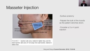 Avoiding an Asymmetric Smile in Masseter Toxin Injections | Vumedi
