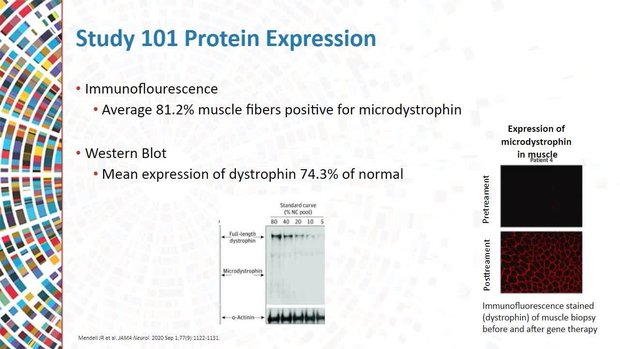 DMD Management in the Era of Gene Therapy | Vumedi