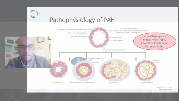 Diagnosis and Management of Pulmonary Arterial Hypertension: How to Use ...
