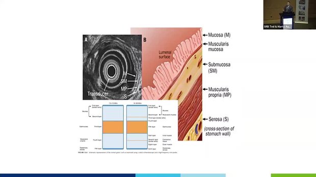 The Role of Endoscopy in Diagnosis and Treatment of Gastric Cancer | Vumedi