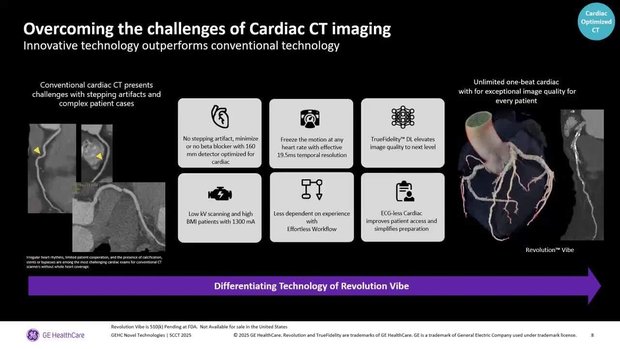 Patient Access: A True Comprehensive Cardiac CT Assessment | Vumedi