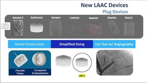 LAA Closure: Newest Devices | Vumedi
