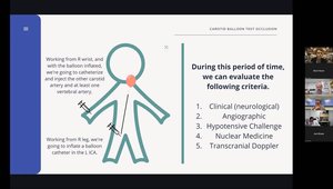 Carotid Artery Pre-Op Risk Assessment: Balloon Test Occlusion | Vumedi