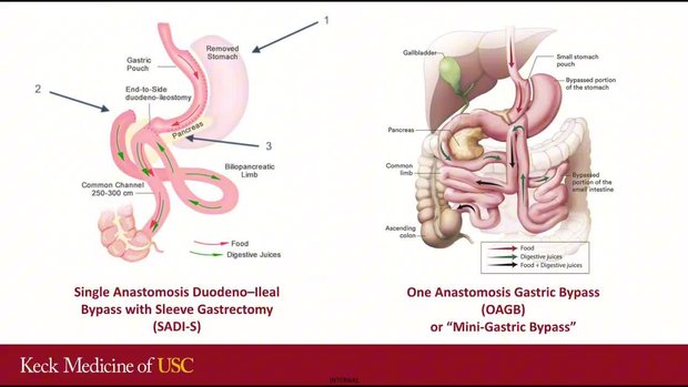 glp 1 forum Forum on Obesity Management: GLP-1a, Endoscopic Procedures and Metabolic  and Bariatric Surgeries