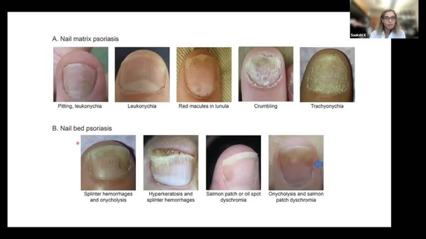 Dermatologic Manifestations in Rheumatic Diseases | Vumedi