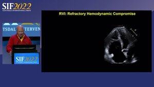 RV Shock: Pathophysiology and Management | Vumedi