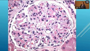 Cleveland Clinic Department of Rheumatic and Immunologic Disease | Vumedi