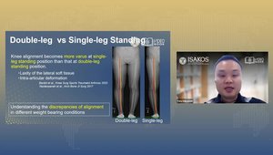 Imaging for Knee Alignment | Vumedi