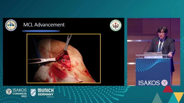 MCL and PMC: Tips and Tricks for the Medial Side of the Knee | Vumedi