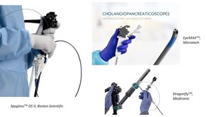 Advanced Endoscopy in Cholangiocarcinoma: Enhancing Diagnostic Accuracy ...