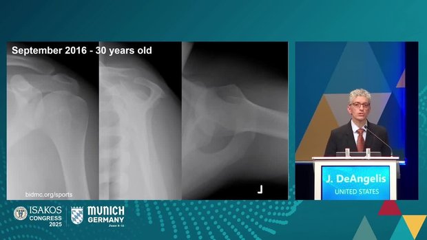 First-Time Dislocation: Imaging from Basic to Advanced | Vumedi