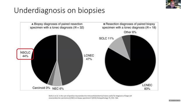 Lung Neuroendocrine Neoplasms: Diagnostic Challenges in Morphologic ...