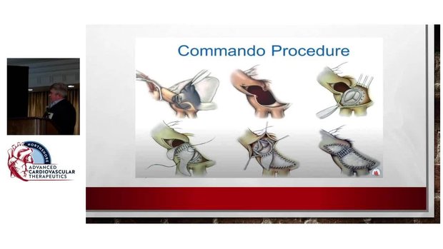 Commando Procedure: 30 Years in the Making | Vumedi