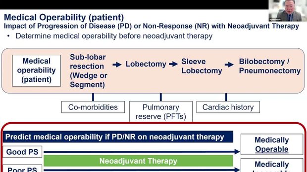 T4 NSCLC Upfront Surgery vs. Neoadjuvant Therapy: Decision-Making in ...