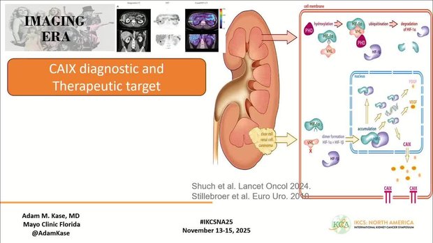 RCC Biomarkers Development: IMDC, Genomics, and Circulating Markers for ...