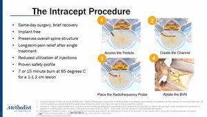 Basivertebral Nerve Ablation | Vumedi