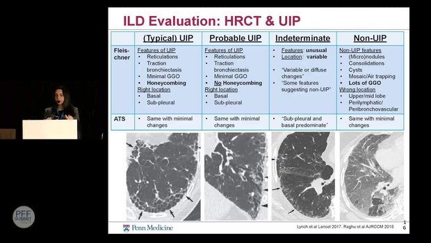 Diagnosis of ILD | Vumedi