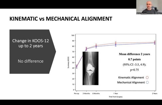Robotic-Assisted and Kinematic Alignment in TKA: The RASKAL Registry ...