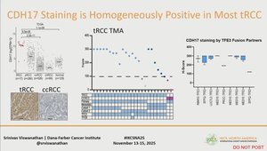 Therapeutic Targeting of Translocation RCC | Vumedi