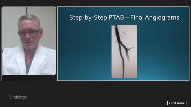 Mastering PTAB with the DETOUR System: A Technical Series with the ...