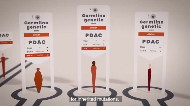 Diagnosis and Management of mPDAC | Vumedi
