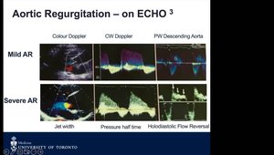 A Practical Approach to Grading Valvular Severity using Transthoracic ...