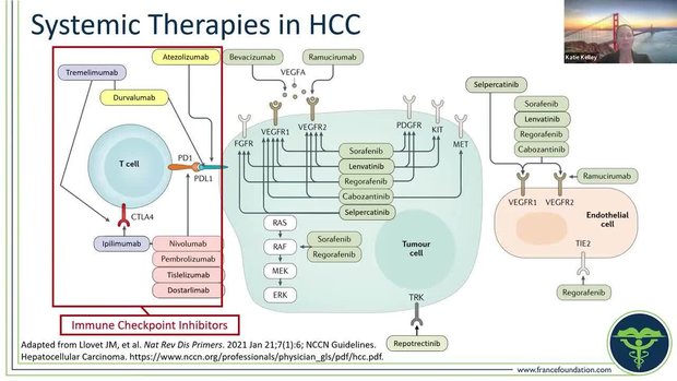 Guidelines for Assessment and Management for Advanced HCC | Vumedi