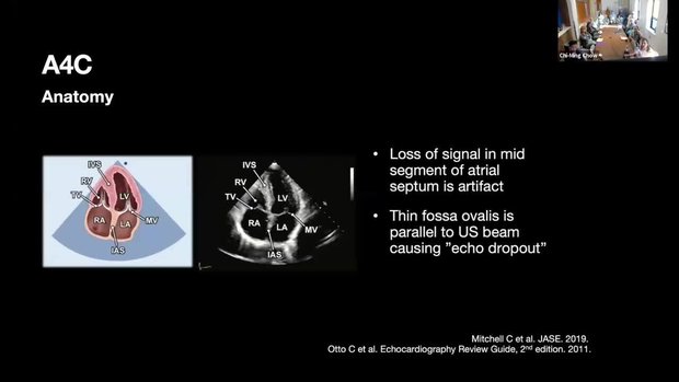 Comprehensive Transthoracic Echocardiogram | Vumedi
