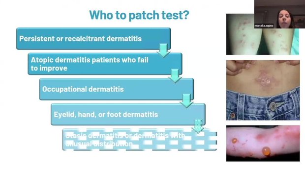 AAAAI 2025 Insights: Allergic & Irritant Contact Dermatitis | Vumedi
