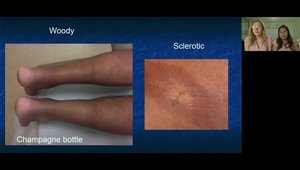 Dermalorian™ Webinar Special Series: Itch & Rash Whisperer Virtual ...